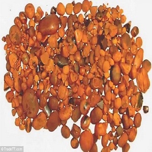 Calculs biliaires de bœuf / bovins / vaches de haute qualité - Product Image 1