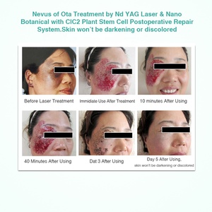 Cosmeceuticals Cuidado DE LA PIEL vegano Nano Spray Healing Herbs ingredientes Kits de cuidado de reparación instantánea Blanqueamiento Tratamiento facial Juego de regalo - Product Image 3