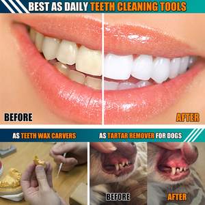 ODM OEM 2026 Set 4 PRO Kit de Sondas Dentales de Acero Inoxidable, Herramientas Manuales de Limpieza e Higiene Bucal - Product Image 5