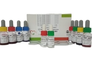 Kits de prueba de ancho Febrile, juego de herramientas para la definición de las regiones de Polonia, Alemania y Polonia - Product Image 2