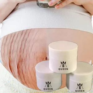 למעלה איכות קרם עבור שחור כתמים וסימן מתיחה הסרת עם מותג פרטי - Product Image 1