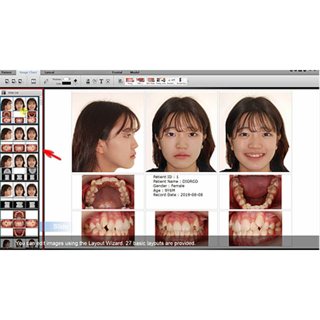 [AUTOLIGN] SmartCeph 2D cephalometric analysis software made in Korea