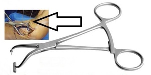 Ludloff Mau Osteotomy Fixation Clamp - Product Image 6