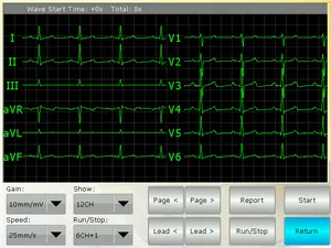 12リード3チャンネル正常な犬犬犬猫ペット犬のためのECG心電図