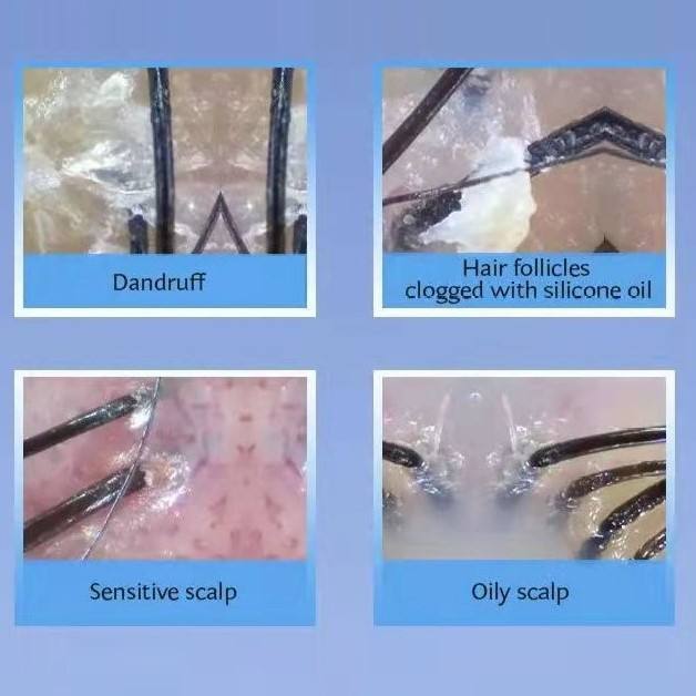 ORANGLES Wireless Hair & Scalp Analyzer | WiFi Digital Microscope Dermascope | Smart Skin Analysis Camera Machine – orangles Qatar - high resolution display - exposing craftsmanship - Image 2 of 6 | built for everyone | Wireless Hair & Scalp Analyzer | WiFi Digital Microscope Dermascope | Smart Skin Analysis Camera Machine – orangles Qatar for sale Georgia | Free Shipping ORANGLES