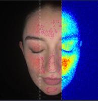 Analyseur de peau MC88 24MP US IT, outil de diagnostic d'image Scope Care, miroir magique, détecteur d'hydratation de la peau du visage