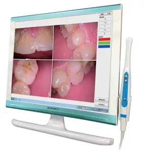 17 дюймов стоматологическая интраоральная камера компьютера для CT панорамная машина с реальными 1080P SONY ПЗС-датчика