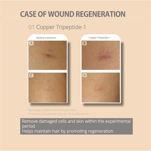 Suero de crecimiento de pestañas para Fórmula Avanzada para pestañas más largas, más completas y más gruesas Mde en Corea, producto de belleza - Product Image 6