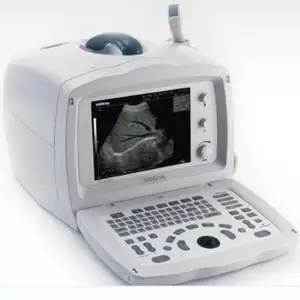 DP-2200 Ultrasonic Diagnostic Imaging Scanner Ultrasound Machine OB Measurement