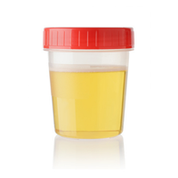 Recipientes de Muestras Estériles de Plástico PP Transparente de Alta Calidad para Uso en Laboratorio de Orina, 50ml/100ml, Personalizables OEM, Marca AARK, Los Mejores