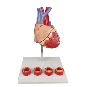 用于医学教学的动脉粥样硬化塑料人体心脏模型
