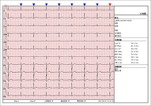 Electrocardiograma para uso veterinario, electrocardiograma para interpretación de ECG para perros, taquicardia y Ventricular - Product Image 2